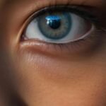 Eye Fillers South Delhi