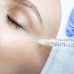 fillers treatment delhi