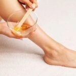 laser hair reduction delhi