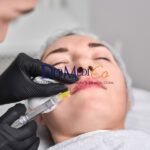 Filler Treatment in Delhi