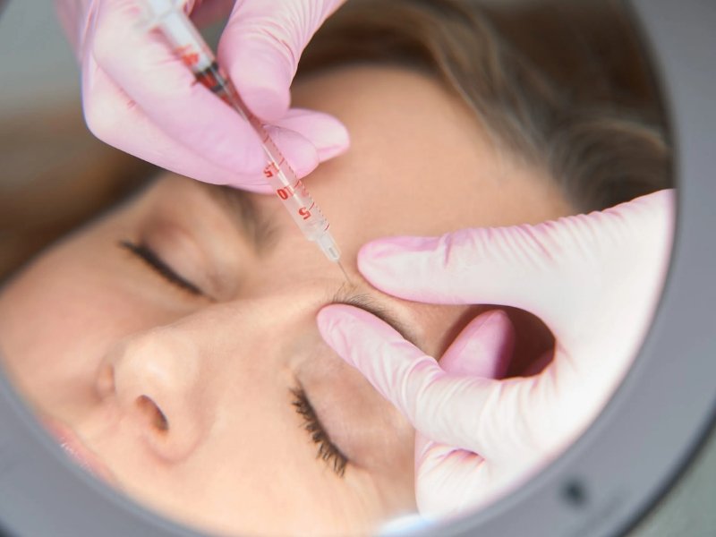 Botox Treatment for Wrinkles