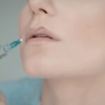 Lip Fillers in Defence Colony